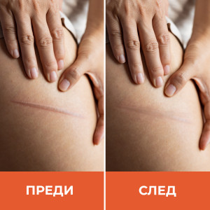 PALMER'S СЕРУМ ЗА БЕЛЕЗИ 30 МЛ. PALMER'S СЕРУМ ЗА БЕЛЕЗИ 30 МЛ.